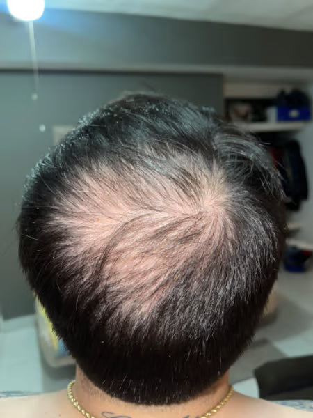 Antes