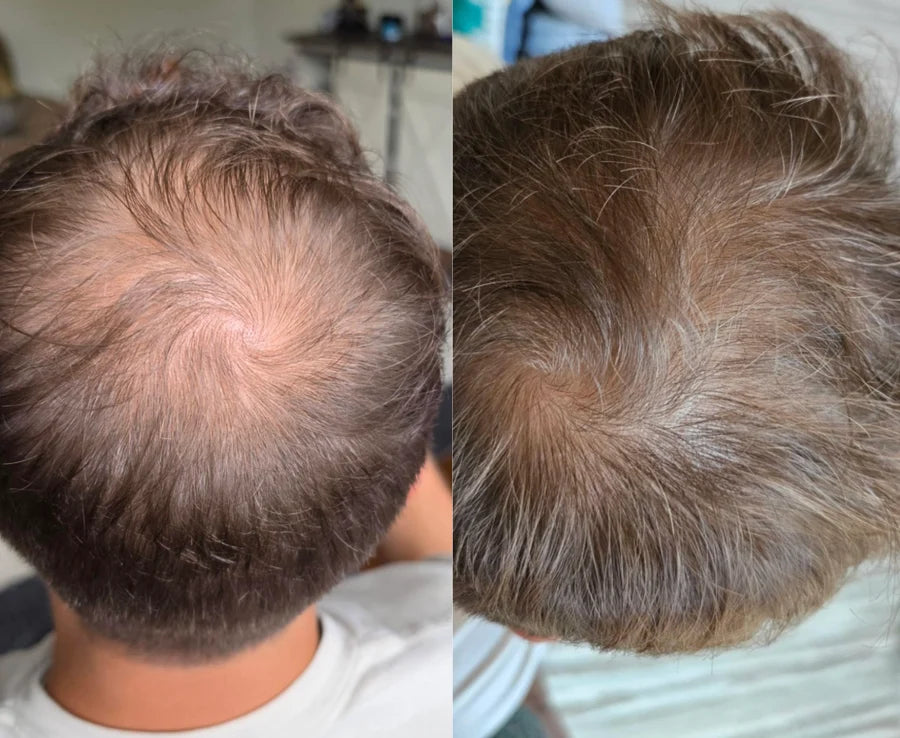 Antes y después de Facundo T.