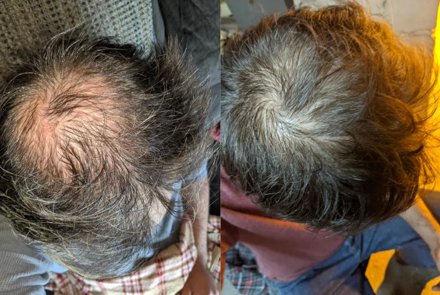 Antes y después de Marcelo G.