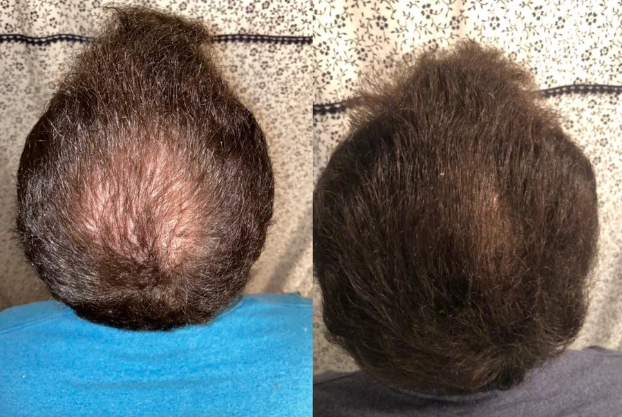 Antes y después de Fernando C.